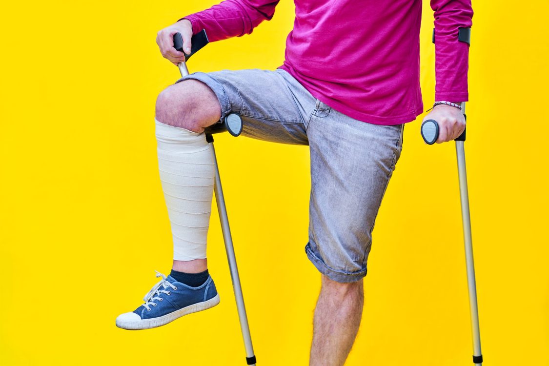 Man wearing on crutches, with one leg bandaged and leaning on a crutch, on a yellow background Unrecognizable man wearing purple t-shirt shorts and on crutches, with one leg bandaged and leaning on a crutch, on a yellow background. Copy space